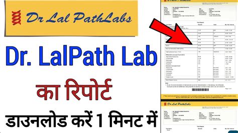 online report dr lal pathlabs|dr lal pathlabs login one regitration.